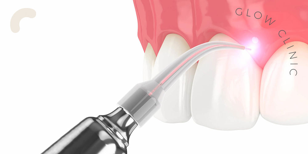 Periodontoloji Dişeti Hastalıkları